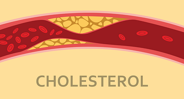 cholesterol-test-limits